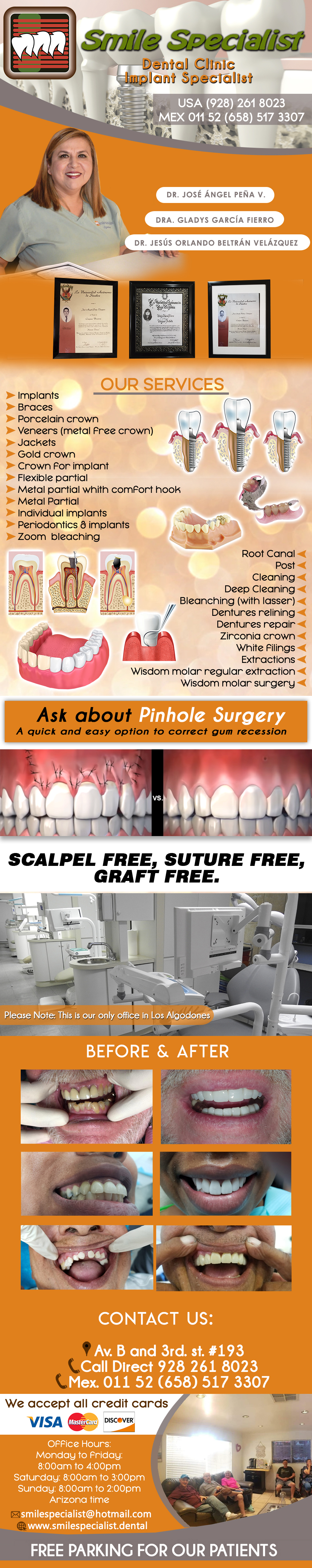 Smile Specialist -Porcelain crown
Veneers (metal free crown)
Jackets
Gold crown
Crown for implant
Flexible partial
Metal partial whith comfort hook
Metal partial
Extractions
Wisdom molar regular extraction
Wisdom molar surgery
Cleaning
Deep Cleaning
Bleanching (with lasser)
Dentures (full set)
Dentures with porcelain teet
Dentures (upper or lower)
Dentures relining
Dentures with mollo
Dentures repair
Lower mini implants
Upper mini implants
White filings
Individual Implants
Braces
Root Canal
Post
Periodontics & Implants
                                    