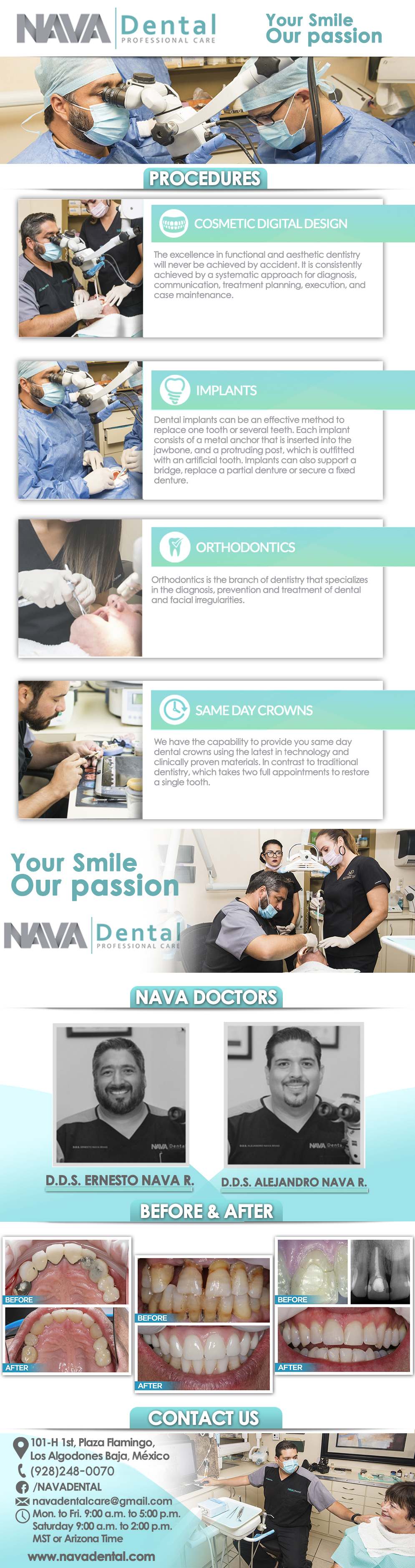 Nava Dental Care-General Dentistry and Specialists We offer complete dental services including general dentistry, cosmetic dentistry, periodontics, endodontics, orthodontics and dental implants. Bridges °X-Rays °Porcelain Veneers °Metal Crowns °Dental Bonding °Deep Cleaning °Denture Repair °Traditional Acrylic Dentures °Prescriptions °Root Canals °Metal Bridges °White Fillings °Root Canal Therapy Relines (Hard or Soft) °General Oral Surgeries °Porcelain Crowns °Flexible Partials °Composite Posts °Teeth Whitening °Extractions °Flexible Parials Implants °Porcelain Veneers °Wisdom Tooth Extractions °Metal Posts °Traditional Cleaning °Metal/Acrylic Partials °Immediate Upper and Lower Dentures (Alveoplasty)                