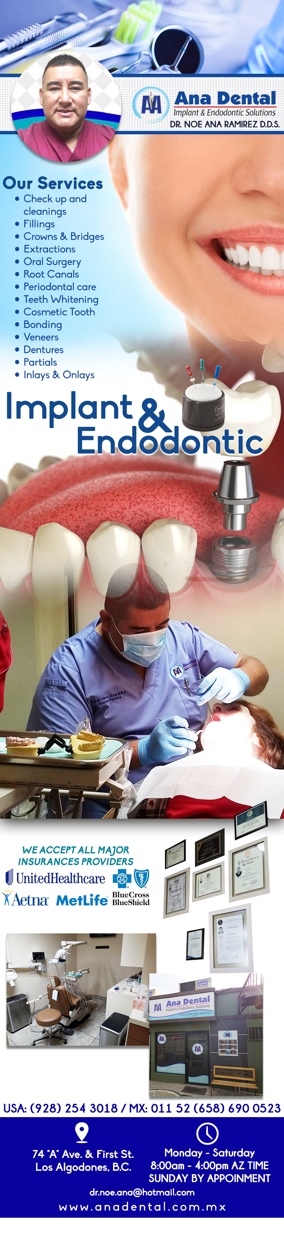 Ana Dental D.D.S. Noe Ana Ramirez-Implant & Endodontic Solutions. Cosmetic Dentistry, Root canal, Therapy, Implants.