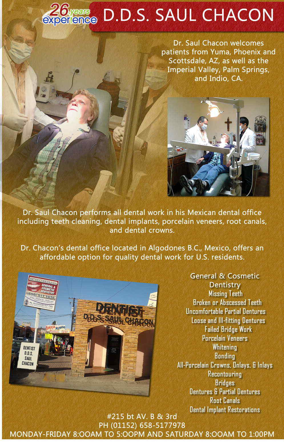 DR. SAUL CHACON in Algodones  in Algodones  ORAL SURGEON DENTIST                 Bridges

X-Rays

Porcelain Veneers

Metal Crowns

Dental Bonding

Deep Cleaning

Denture Repair	Traditional Acrylic Dentures

Prescriptions

Root Canals

Metal Bridges

White Fillings

Root Canal Therapy

Relines (Hard or Soft)	General Oral Surgeries

Porcelain Crowns

Flexible Partials

Composite Posts

Teeth Whitening

Extractions

Flexible Parials	Implants

Porcelain Veneers

Wisdom Tooth Extractions

Metal Posts

Traditional Cleaning

Metal/Acrylic Partials


 Immediate Upper and Lower Dentures (Alveoplasty) maps        