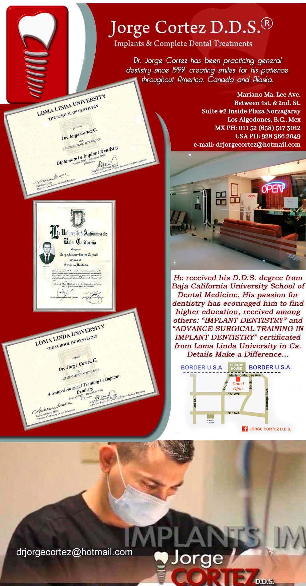 Jorge Cortez D.D.S.®-Dr. Jorge Cortez has been practicing general destistry since 1999, creating smiles for his patience throughout America, Canada and Alaska. He received his D.D.S. degree from Baja California University School of Dental Medicine. His passion for dentistry has ecouraged him to find higher education, received among others: "IMPLANT DENTISTRY" and "ADVANCE SURGICAL TRAINING IN IMPLANT DENTISTRY" certificated from Loma Linda University in Ca.
Details Make a Difference...                