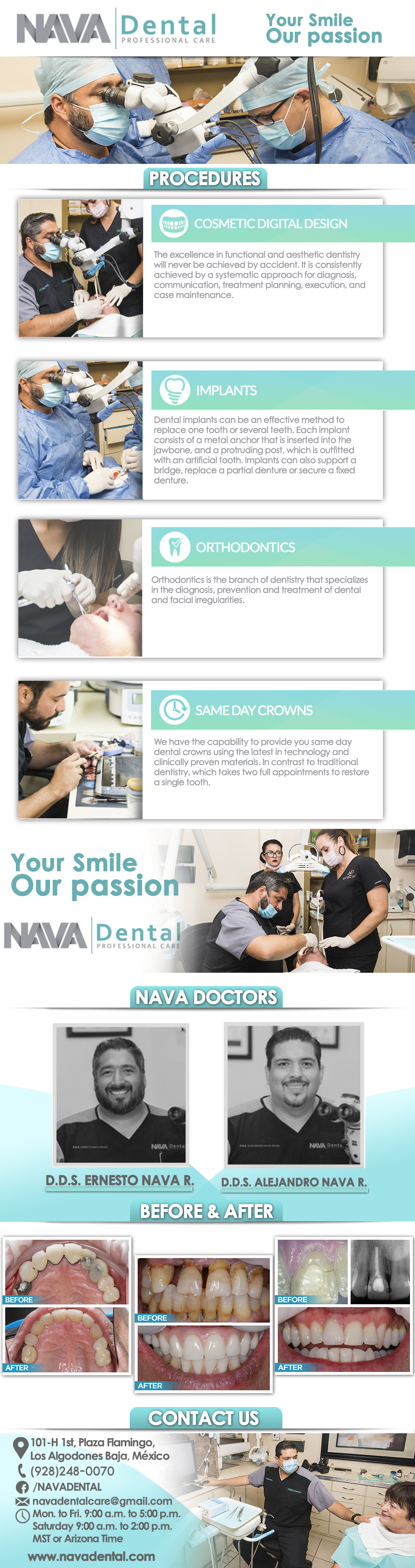 Nava Dental Care in Algodones  in Algodones  General Dentistry and Specialists We offer complete dental services including general dentistry, cosmetic dentistry, periodontics, endodontics, orthodontics and dental implants. Bridges °X-Rays °Porcelain Veneers °Metal Crowns °Dental Bonding °Deep Cleaning °Denture Repair °Traditional Acrylic Dentures °Prescriptions °Root Canals °Metal Bridges °White Fillings °Root Canal Therapy Relines (Hard or Soft) °General Oral Surgeries °Porcelain Crowns °Flexible Partials °Composite Posts °Teeth Whitening °Extractions °Flexible Parials Implants °Porcelain Veneers °Wisdom Tooth Extractions °Metal Posts °Traditional Cleaning °Metal/Acrylic Partials °Immediate Upper and Lower Dentures (Alveoplasty)                 General Dentistry and Specialists We offer complete dental services including general dentistry, cosmetic dentistry, periodontics, endodontics, orthodontics and dental implants. Bridges °X-Rays °Porcelain Veneers °Metal Crowns °Dental Bonding °Deep Cleaning °Denture Repair °Traditional Acrylic Dentures °Prescriptions °Root Canals °Metal Bridges °White Fillings °Root Canal Therapy Relines (Hard or Soft) °General Oral Surgeries °Porcelain Crowns °Flexible Partials °Composite Posts °Teeth Whitening °Extractions °Flexible Parials Implants °Porcelain Veneers °Wisdom Tooth Extractions °Metal Posts °Traditional Cleaning °Metal/Acrylic Partials °Immediate Upper and Lower Dentures (Alveoplasty)                