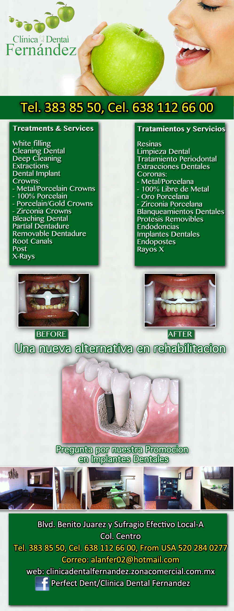 CLINICA DENTAL FERNANDEZ-ODONTOLOGIA ESTETICA, ODONTOPEDIATRA E IMPLANTES DENTALES, LIMPIEZAS Y BLANQUEAMIENTOS.     