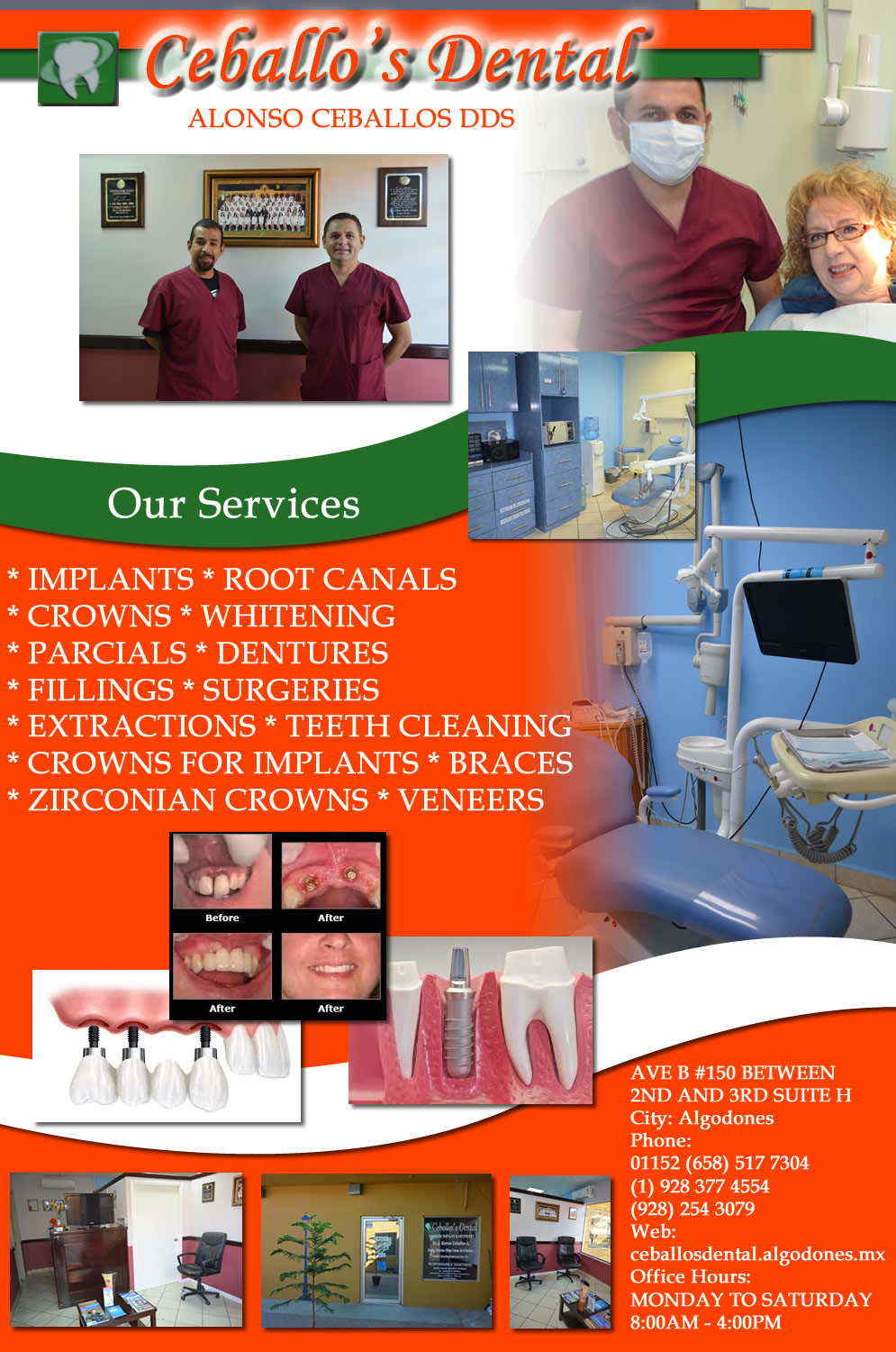 CEBALLOS DENTAL DDS ALONSO CEBALLOS in Algodones  in Algodones  * IMPLANTS * ROOT CANALS * CROWNS * WHITENING * PARCIALS * DENTURES * FILLINGS * SURGERIES * EXTRACTIONS * TEETH CLEANING * CROWNS FOR IMPLANTS * BRACES * ZIRCONIAN CROWNS * VENEERS          IMPLANTS  ROOT CANALS  CROWNS  WHITENING  PARCIALS  DENTURES  FILLINGS  SURGERIES  EXTRACTIONS TEETH CLEANING  CROWNS FOR IMPLANTS BRACES  ZIRCONIAN CROWNS  VENEERS        