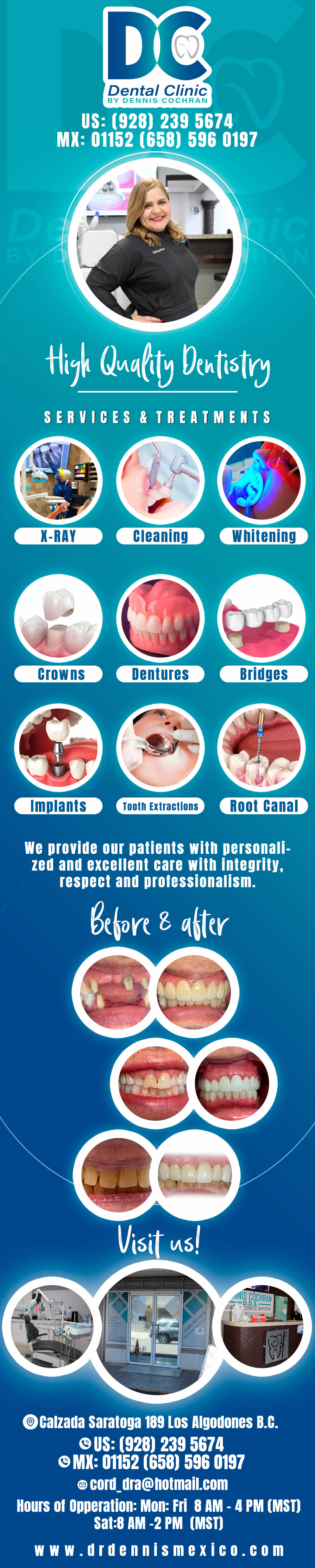 Dra. Dennis Cochran D.D.S. in Algodones  in Algodones  General & Cosmetic Dentistry. Services: Implants,
Crown Over Implant,
Implant & Crown,
Wisdom Tooth Surgery,
Crown Lengthening,
Dentures,
Metal and Acrilic Partials,
Flexible Partials,
Deep Cleaning,
X-Rays,
Cleaning,
White Fillings,   
Extractions,
Root Canal,
Fiber Glass Post,
Whitening,
Metal/Porcelan Crown,
Hard Relines,
Soft Relines.                     general cosmetic dentistry  dentista dental d c dc dental    Extractions dentist dra dennise denisse denise cochran dennisse  denis 
Root Canal
Fiber Glass Post
Whitening
Metal/Porcelan Crown
Hard Relines
Soft Relines  
Implants
Crown Over Implant
Implant & Crown
Wisdom Tooth Surgery
Crown Lengthening
Dentures
Metal and Acrilic Partials
Flexible Partials
Deep Cleaning
X-Rays
Cleaning
White Fillings                           