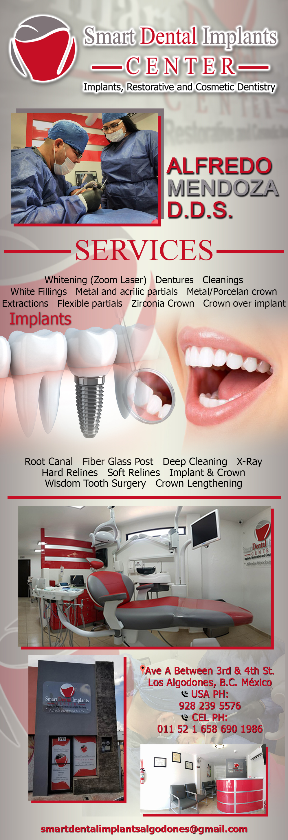 Smart Dental Implants Alfredo Mendoza DDS in Algodones  in Algodones  Implants
Crown Over Implant
Implant & Crown
Wisdom Tooth Surgery
Crown Lengthening
Dentures
Metal and Acrilic Partials
Flexible Partials
Deep Cleaning
X-Rays
Cleaning
White Fillings
Extractions
Root Canal
Fiber Glass Post
Whitening
MetalPorcelan Crown
Hard Relines
Soft Relines         Implants
Crown Over Implant
Implant & Crown
Wisdom Tooth Surgery
Crown Lengthening
Dentures
Metal and Acrilic Partials
Flexible Partials
Deep Cleaning
X-Rays
Cleaning
White Fillings
Extractions
Root Canal
Fiber Glass Post
Whitening
MetalPorcelan Crown
Hard Relines
Soft Relines
EXTRACION
DOCTOR DOCTORA DIENTE MUELA RELLENO PORCELANA METAL LIMPIEZA DENTISTA DENTAL CORONA RAYOS X RELLENOS LIMPIEZA limpiezas PROFUNDA PROFUNDAS CARIES IMPLANTE IMPLANTES DIENTES CORONAS        