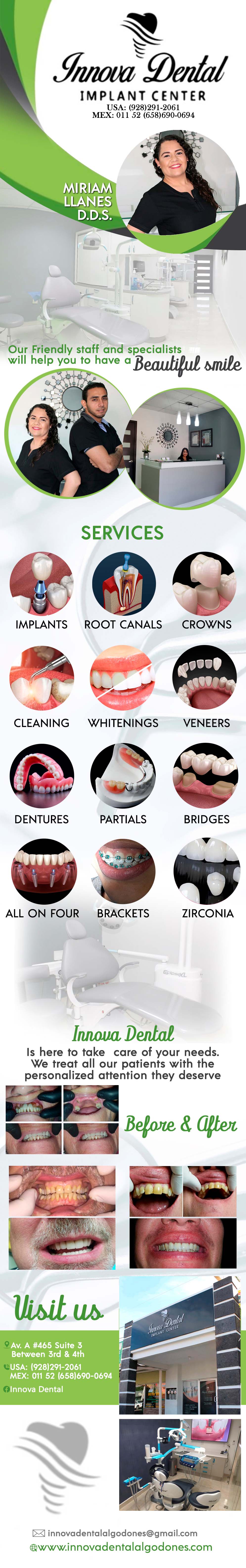 INNOVA DENTAL- Miriam Llanes D.D.S. in Algodones  in Algodones  INNOVA DENTAL. Implants, Root Canals,  Crowns, Cleanings,  Whitenings,   Veneers, Dentures, Partials, Bridges,  All on Four, Brackets,  Zirconia. 
                         Innova Dental, Implants, Root Canals,  Crowns,
Cleanings,  Whitenings,   Veneers,
Dentures,   Partials,   Bridges   inova dentall  miriam miryam myriam mirian yanez    miriam llanes llanez yanes                   