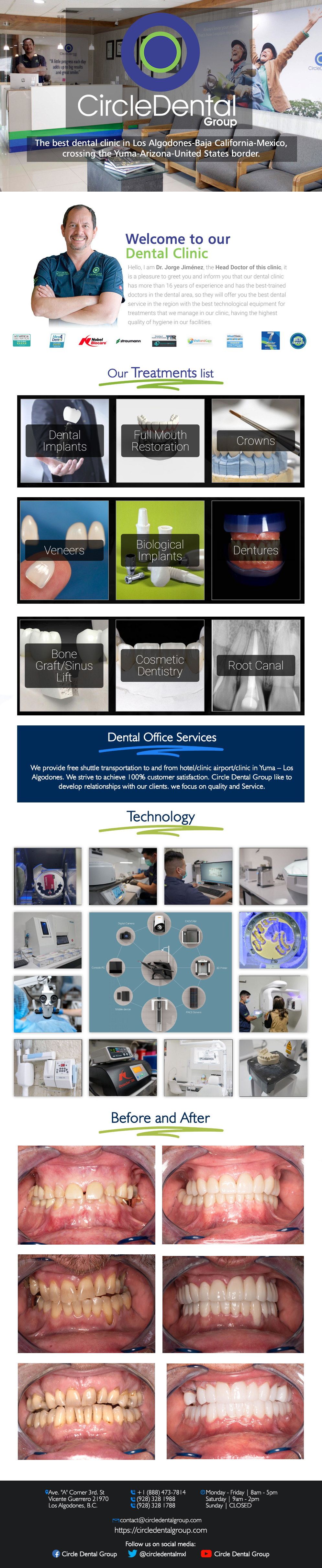 Circle Dental Group  Dr. Jorge Jimenez DDS in Algodones  in Algodones  We are a high-quality dental clinic in Los Algodones, specializing in dental implants, veneers, All on 4, dental crowns, and more treatments. For the last 20 years, Circle Dental has earned the trust of patients in the US and CANADA as well as the top authorities in the dental field such as the American Dental Association). Our 10 specialists have extensive training and are always ready to serve you with professionalism and care. They have a lot of experience, ranging from 5 up to 20 years of experience and are specialized in a field of Dentistry. jorge jimenez dds d.d.s. doctor dentist dental dentistry dental implants Teeth Cleaning
Root Scaling Deep cleaning crowns venners 
Zirconia Crown Regular 
Zirconia Crown Premium	
Porcelain Fused to Gold Crown 	
Porcelain Fused to Metal Crown PFM 	
RE-CEMENT CROWN Veneer Emax or Zirconia
Teeth Whitening Resin composite filling (white)  simple extraction Wisdom tooth extraction